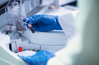 Pesaro - Il laboratorio analisi lascia Muraglia, lunedì sarà in via Redipuglia